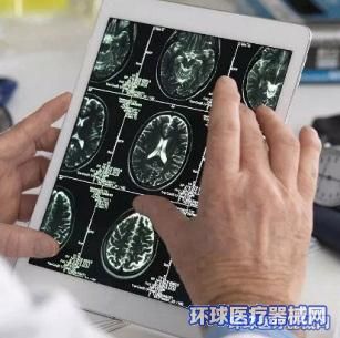 醫(yī)用云膠片服務(wù)商哪家強 北京云醫(yī)康與云影、影像云膠片的競爭力分析